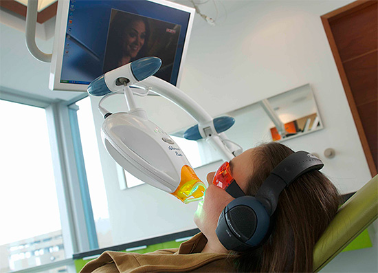 Clareamento dos dentes Zoom