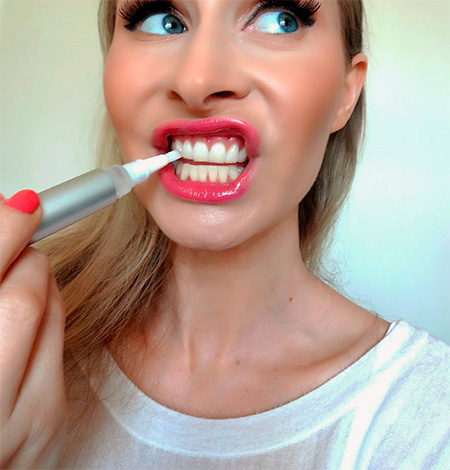 Para o clareamento dos dentes em casa, os chamados lápis de clareamento são muito populares hoje em dia.