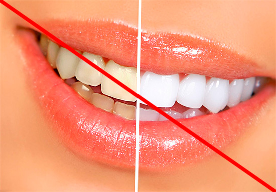 Você não deve esperar que uma pasta de dente branqueadora lhe forneça um sorriso branco como a neve, mas é capaz de torná-la um pouco mais branca (embora nem sempre).