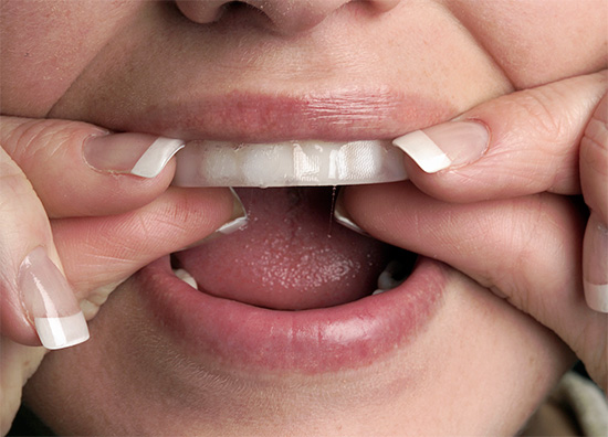 Você pode clarear os dentes em casa usando as chamadas tiras de clareamento ...