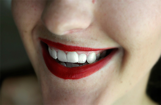 Se você pintar os lábios com batom vermelho, os dentes no fundo dela ficarão mais brancos ...