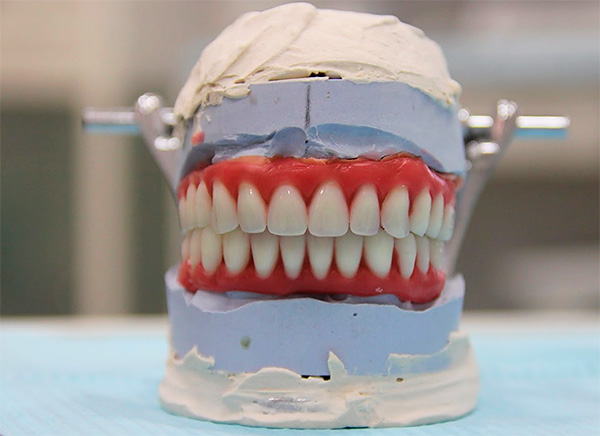 Com atrofia significativa do tecido ósseo, são utilizadas próteses, cuja base imita as gengivas - isso permite que o resultado da prótese seja o mais esteticamente possível possível.