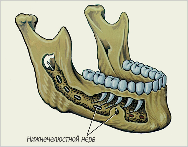 A figura mostra a passagem do nervo mandibular na mandíbula inferior.
