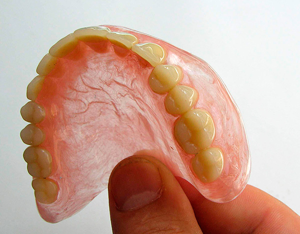 Uma prótese total é uma alternativa aos implantes dentários, mas longe de ser a mais agradável.