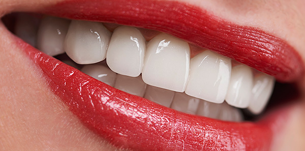 Se você sonha com implantes não cirúrgicos de dentes, primeiro vamos entender se existe, ou é apenas um golpe publicitário ...