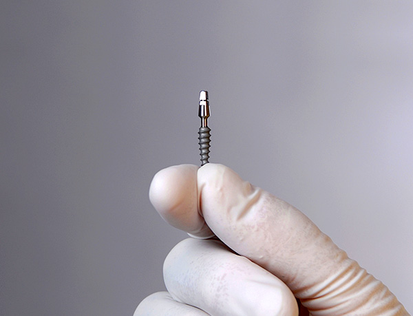 Vamos tentar descobrir se os implantes podem realmente causar danos à saúde e quais são as contra-indicações à sua instalação ...