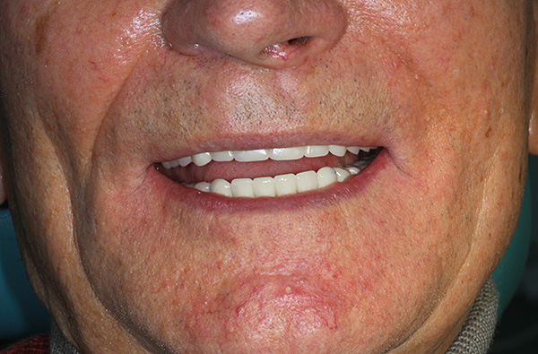 Como você pode ver, mesmo na velhice, você pode ter um sorriso muito bonito.