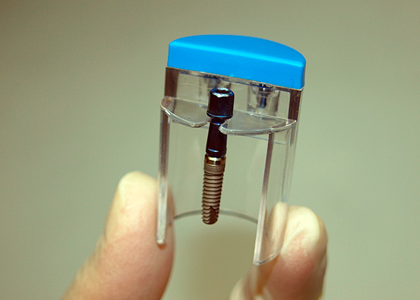 A qualidade dos implantes dentários utilizados afeta significativamente o resultado do trabalho do implantologista e a probabilidade de complicações.
