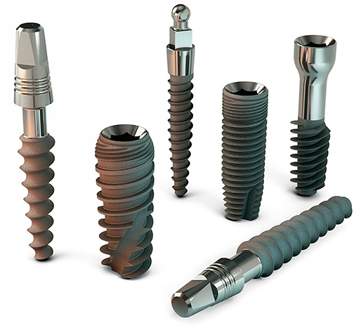 A foto mostra exemplos de implantes dentários.