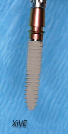 A estabilidade primária dos implantes XiVE na mandíbula é bastante boa e o tecido ósseo é minimamente lesionado pela escultura.