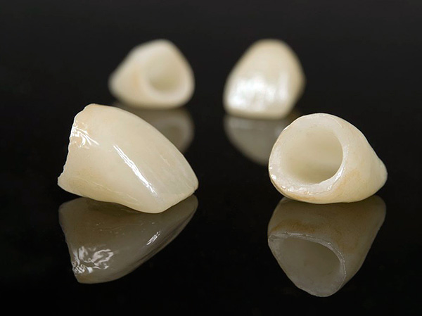 Coroas de zircônia