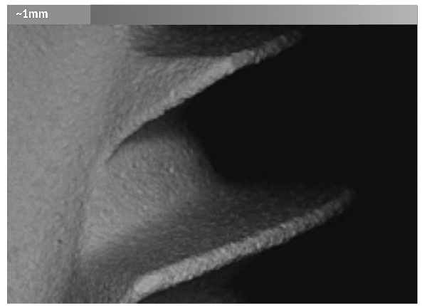 A foto mostra a superfície do implante Alpha Bio sob um microscópio.