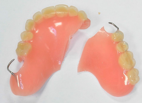 Dentadura acrílica quebrada