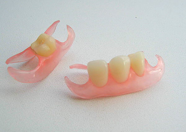 Vamos falar sobre as dentaduras de borboletas e o que considerar ao usá-las ...