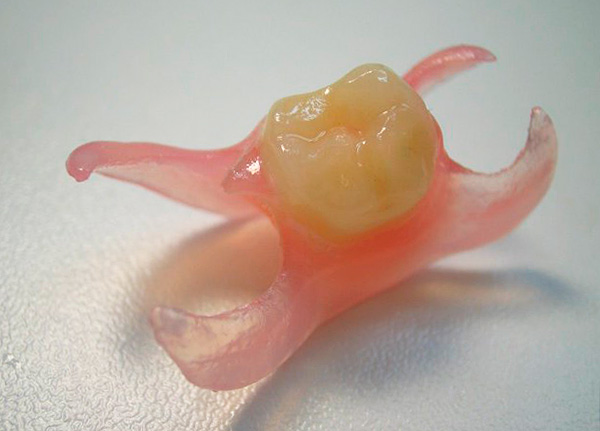 E esta é uma prótese de um dente para mastigar.