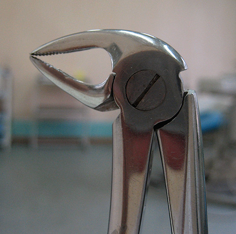 Molte persone si aspettano di rimuovere i denti problematici gratuitamente, a volte dimenticando che questa opzione ha una serie di svantaggi significativi ...