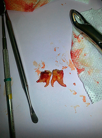 La situazione nell'ufficio di un dentista-chirurgo in una clinica cittadina a volte è abbastanza spaventosa.