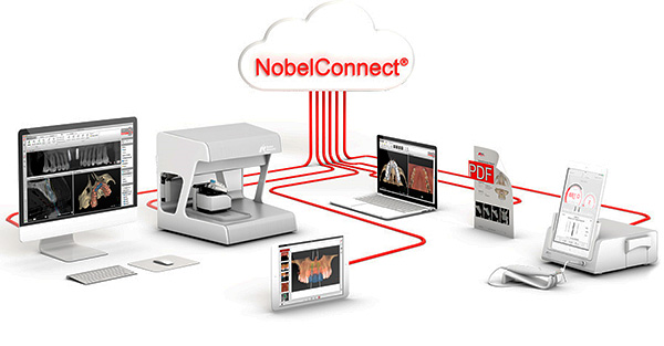 Um componente importante do processo protético do All-on-4 é o uso de software especial que permite a modelagem 3D do próximo procedimento.