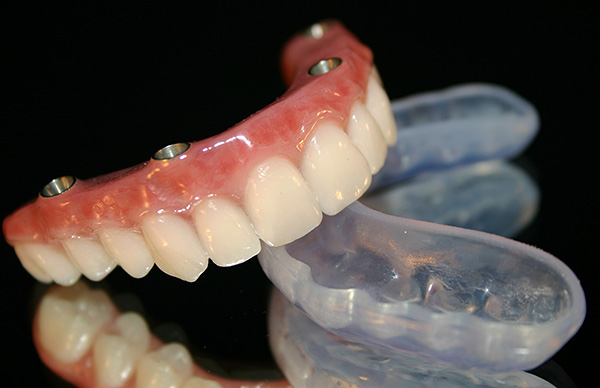 Dentadura (All-on-4)