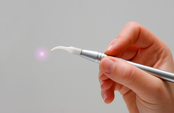 Hoje, na publicidade de muitas clínicas dentárias, você pode encontrar um serviço para o tratamento de cistos dentários com um laser ...