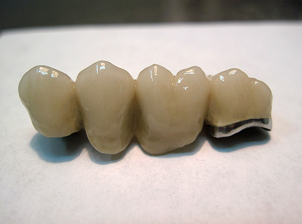 Corone in metallo-plastica