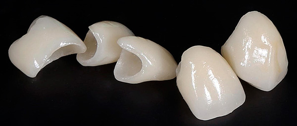 Le corone di zirconia sono le più costose.