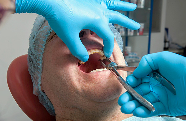 O dente é firmemente mantido no orifício pelo aparato ligamentar, de modo que o médico deve fazer esforços significativos ao se soltar.