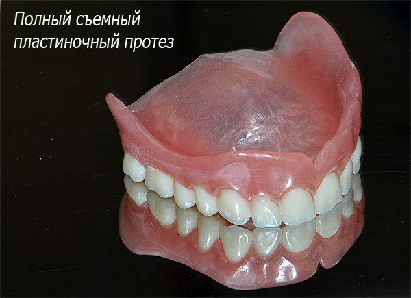 A foto mostra uma dentadura laminar removível completa - ela é mantida na cavidade oral, aspirando as gengivas e o palato.