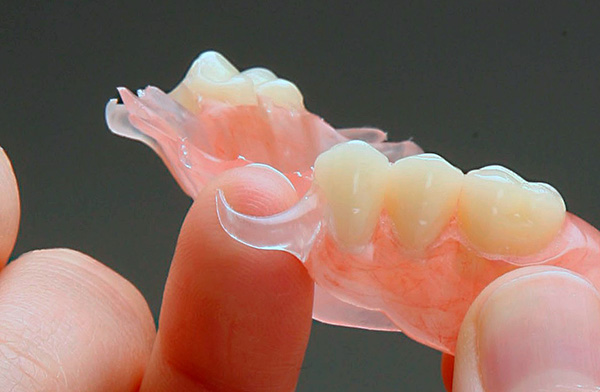 Ganchos de nylon macio não são capazes de segurar com segurança a estrutura na cavidade oral.