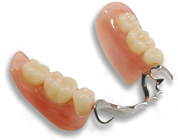 Em muitos casos clínicos, o uso de uma prótese de fecho é a melhor opção para próteses de dentes perdidos.