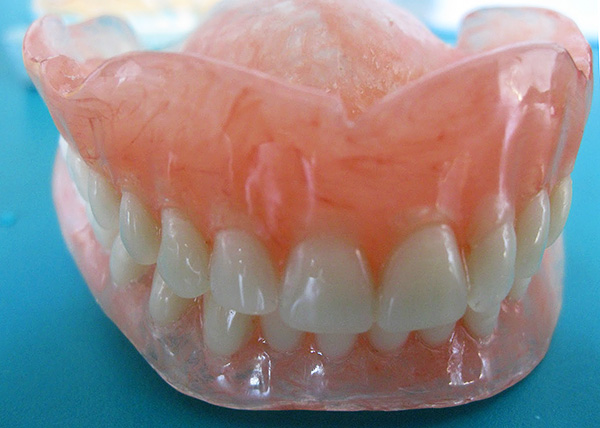 Próteses totais de nylon removíveis (nas mandíbulas superior e inferior).