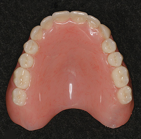 Atualmente, as próteses de plástico acrílico rígido continuam sendo a opção mais barata para próteses, com uma completa ausência de dentes na boca.