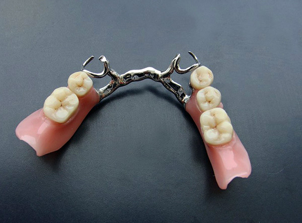 Você deve mostrar sua prótese pelo menos uma vez por ano a um dentista ortopédico ...