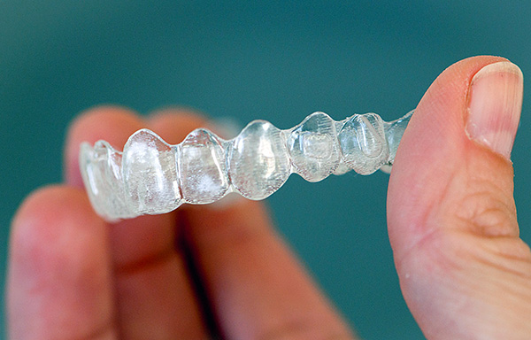 Atualmente, as clínicas dentárias posicionam esses protetores bucais como um substituto completo para os sistemas de braquetes.