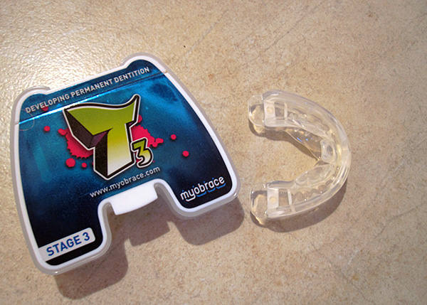 Myobrace no core