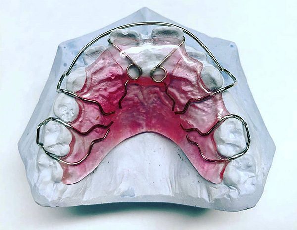 Este dispositivo permite ajustar efetivamente a posição dos dentes na mandíbula superior.