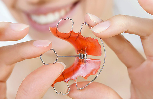 Os aparelhos ortodônticos dentários possuem um parafuso que permite expandir a mandíbula.