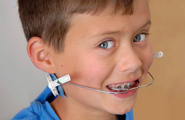 O arco facial permite, por exemplo, definir a inclinação dos dentes da frente na cavidade oral.