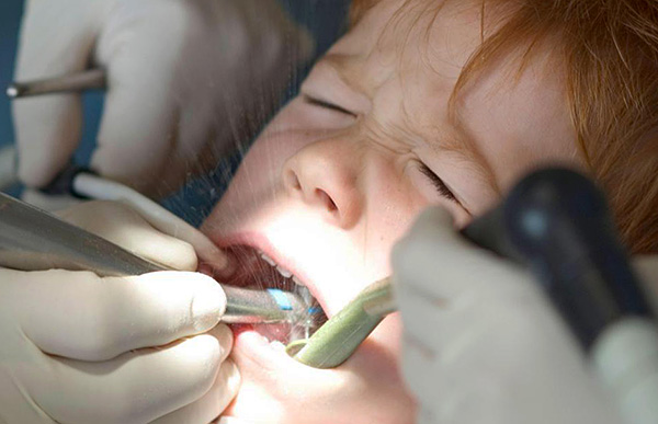 Deve-se entender que a causa da dor prolongada no dente pode muito bem ser um erro médico cometido pelo dentista durante o tratamento da pulpite.