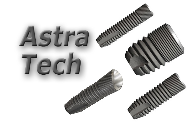 Consideramos as vantagens e desvantagens dos implantes Astra Tech (Suécia) ...