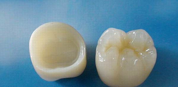 Corone in zircone sui denti da masticare.
