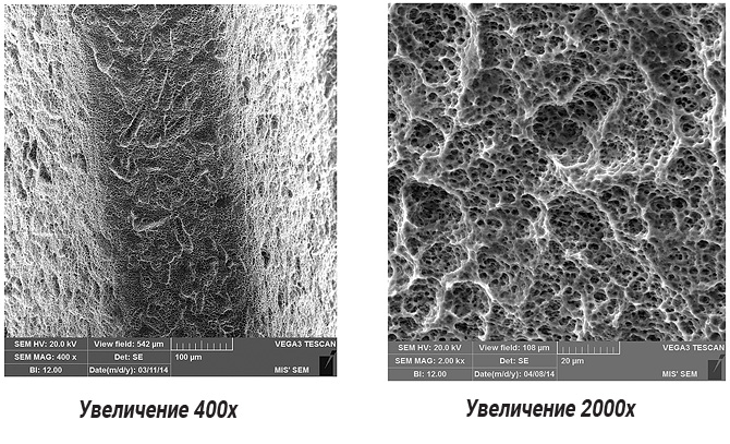 Ecco come appare la superficie degli impianti MIS al microscopio elettronico.