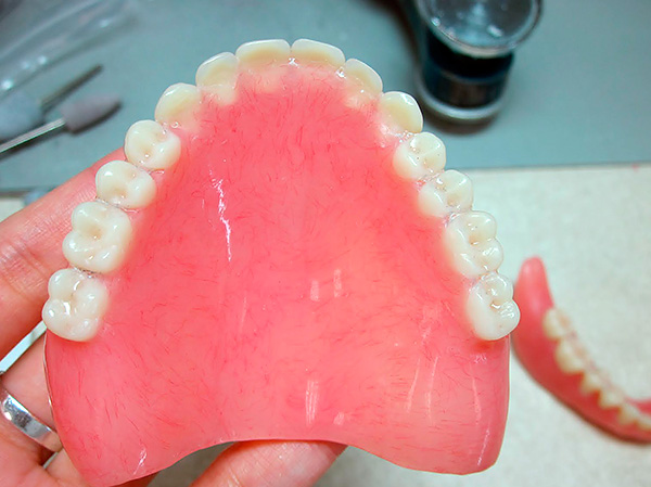 Nos mini-implantes, você também pode fixar uma prótese acrílica antiga, que foi modificada anteriormente.